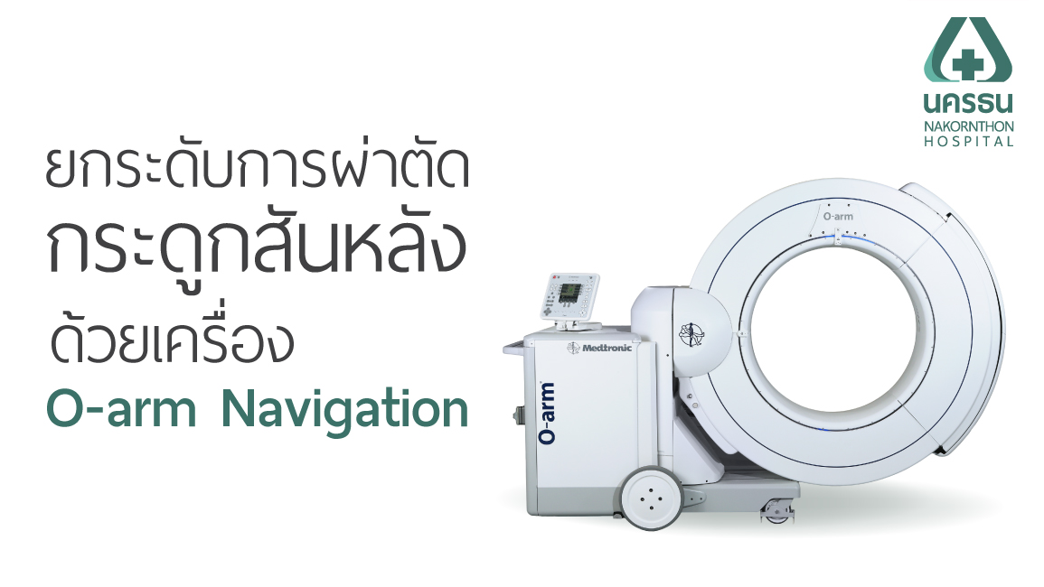 O-arm Navigation